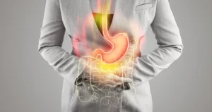 Acid Reflux