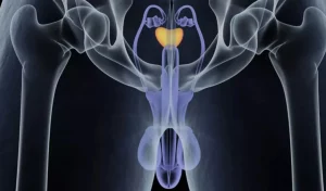 Stages of Prostate Cancer