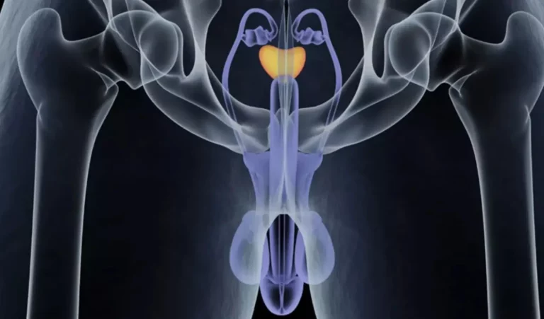 Understanding the 4 Stages of Prostate Cancer and Its Final Phase Stages of Prostate Cancer