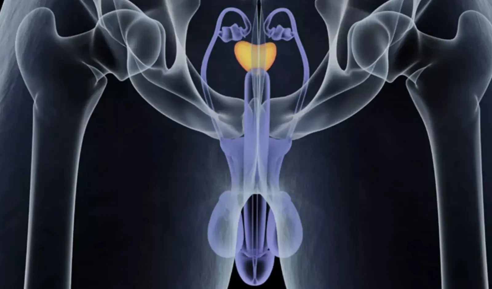 Stages of Prostate Cancer