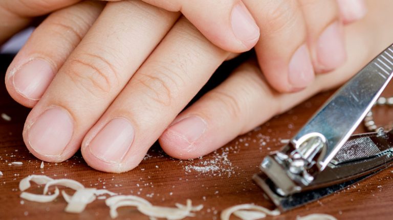 What to Do If You Trim Your Nails Too Short What to Do If You Trim Your Nails Too Short